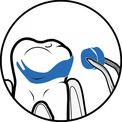 STEP2